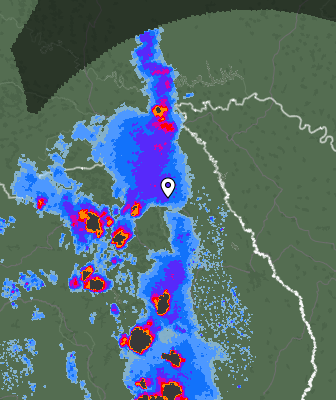 Radar