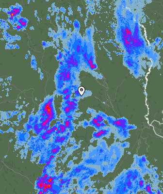 Radar