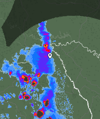 Radar