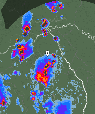 Radar