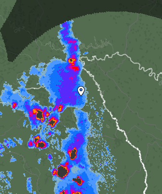 Radar