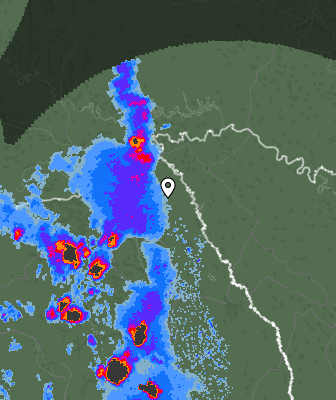 Radar