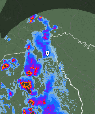 Radar