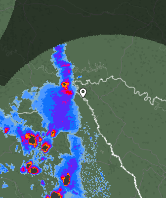 Radar
