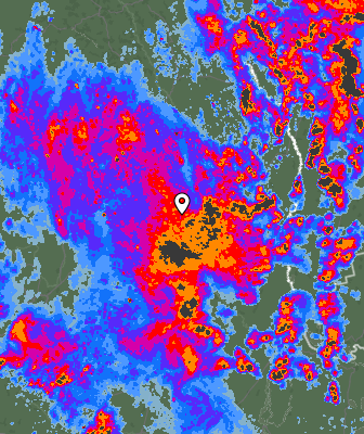 Radar