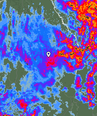 Radar