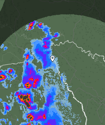 Radar