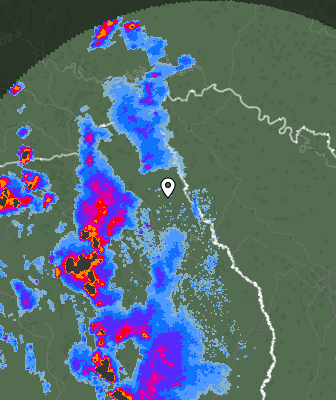 Radar
