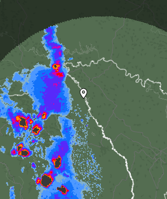 Radar