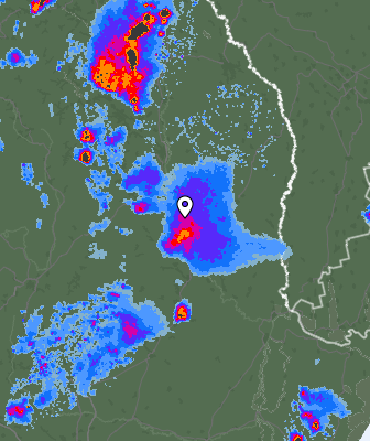Radar