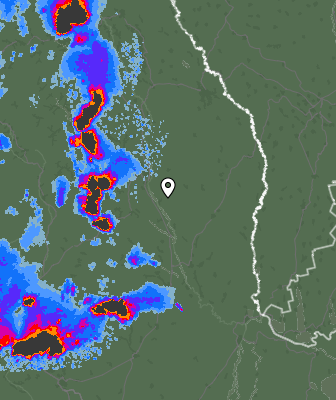 Radar