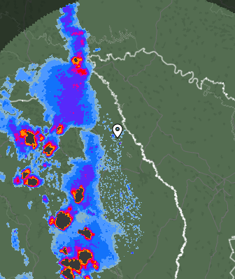 Radar