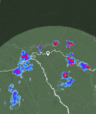 Radar