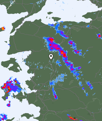 Radar