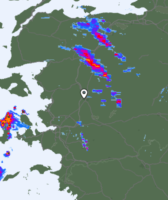 Radar