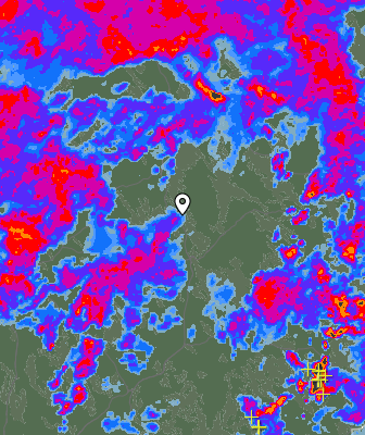 Radar