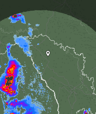 Radar