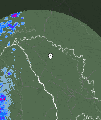 Radar