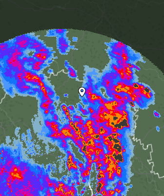 Radar