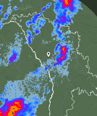 Radar