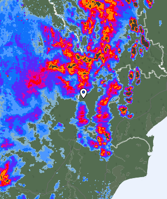 Radar