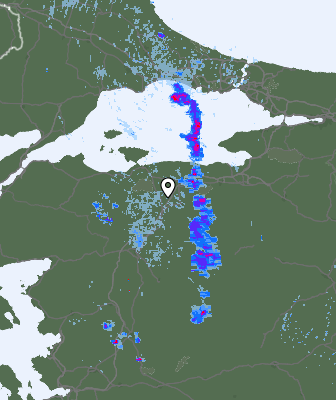Radar