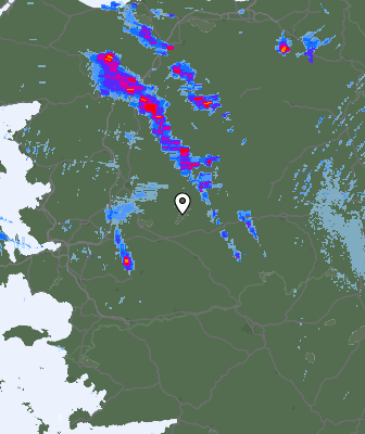 Radar
