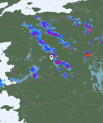 Radar