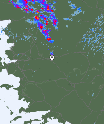 Radar