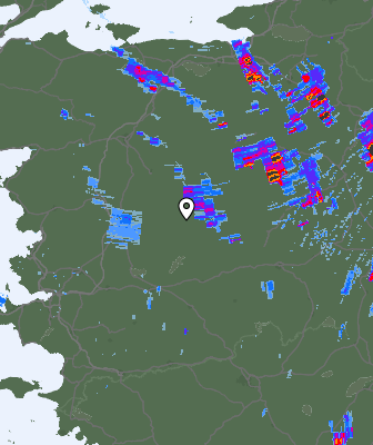 Radar