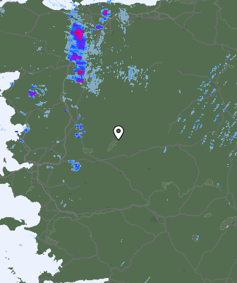 Radar