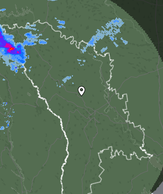 Radar