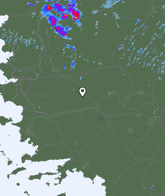 Radar