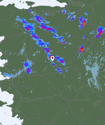Radar