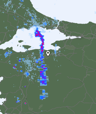 Radar
