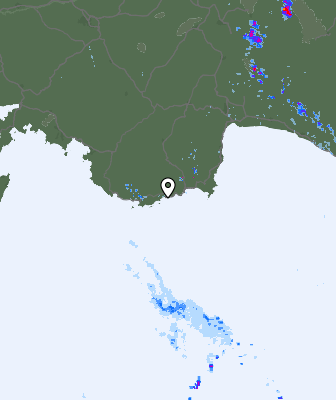 Radar
