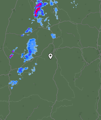 Radar
