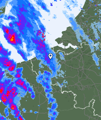 Radar