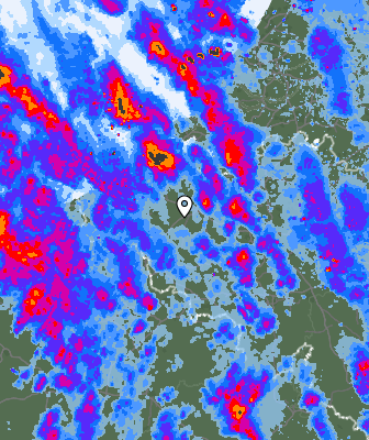 Radar