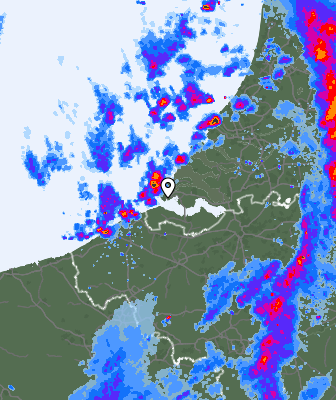 Radar