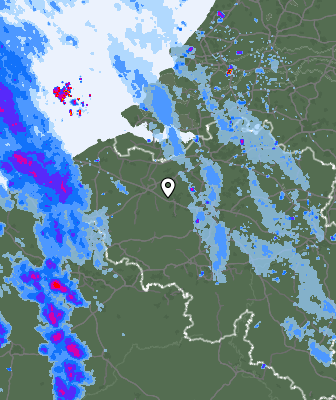 Radar