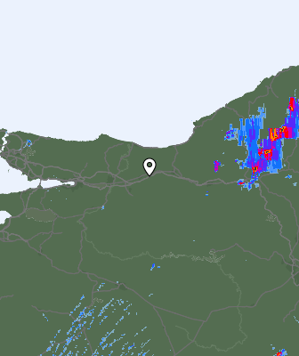 Radar