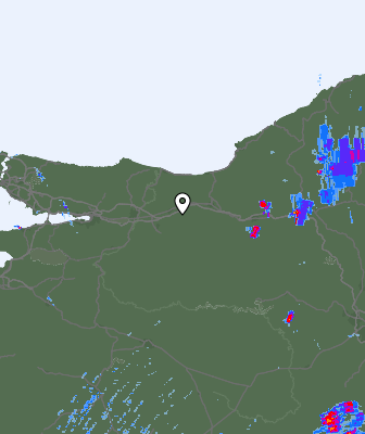 Radar