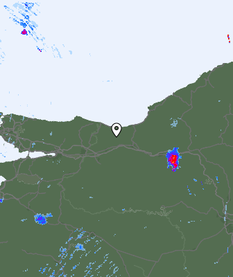 Radar