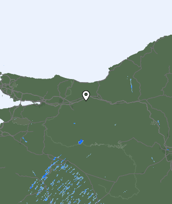 Radar