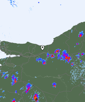 Radar