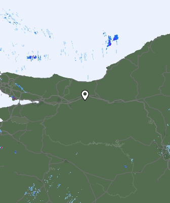 Radar