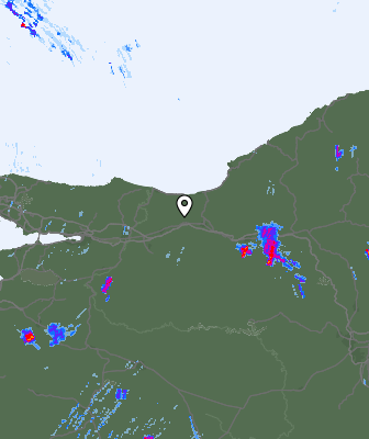 Radar