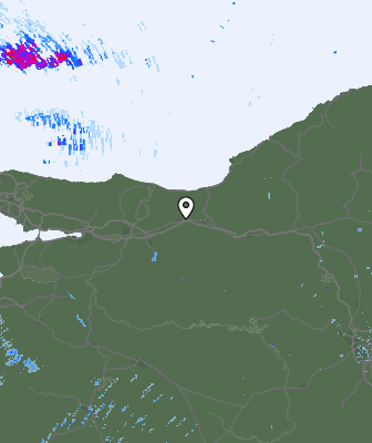 Radar
