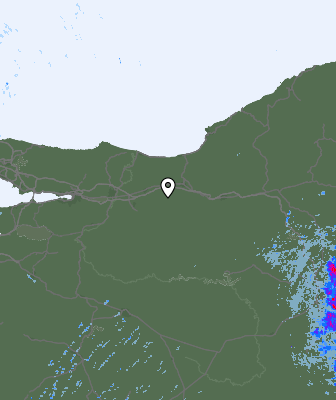 Radar